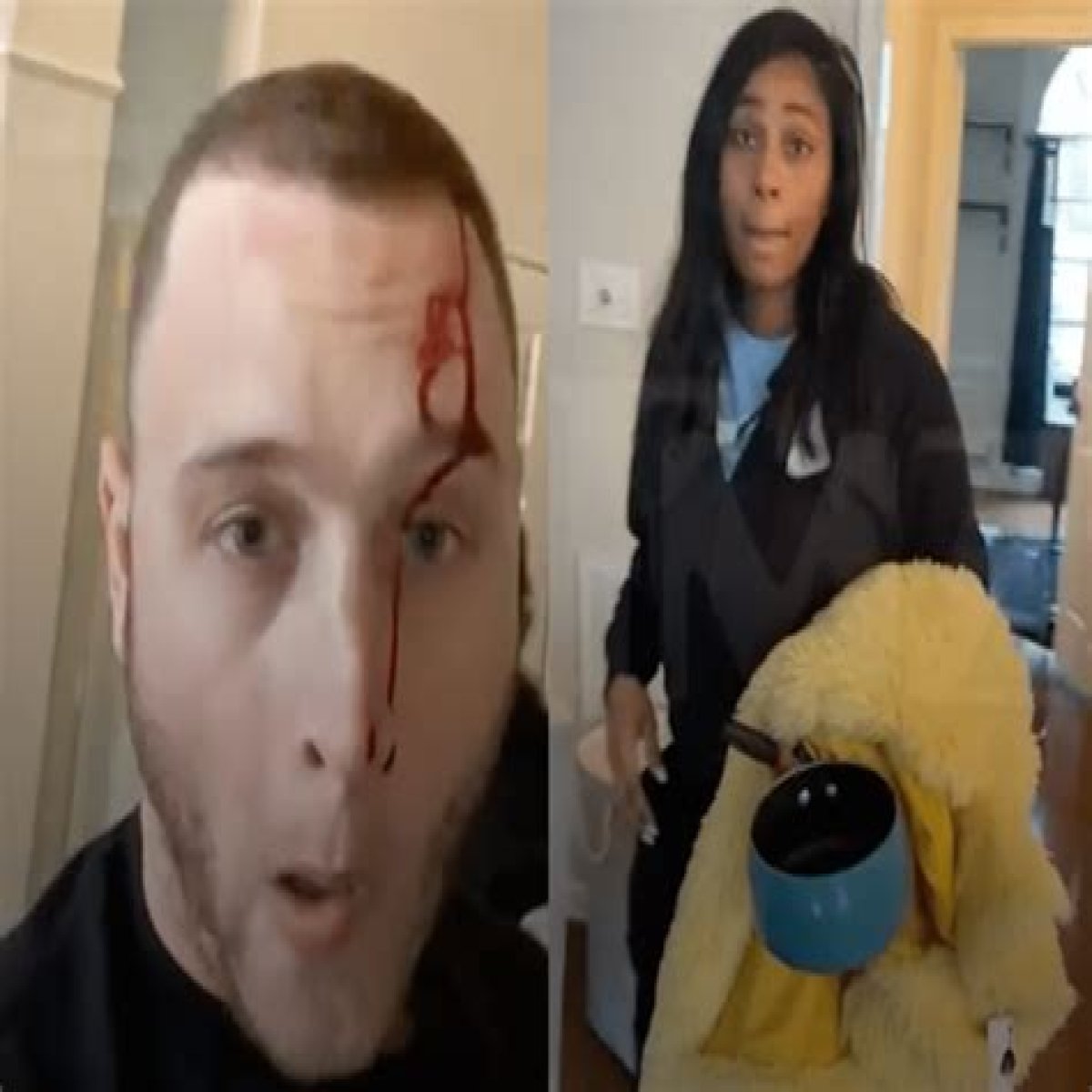 Chet Hanks: My Girlfriend Stabbed Me In the Head!