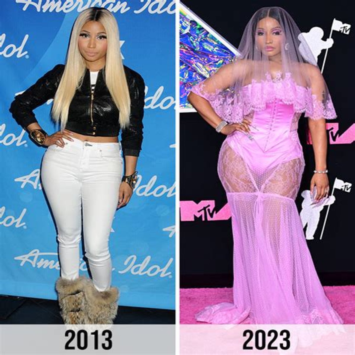 Did Nicki Minaj Ever Get Plastic Surgery? See Photos of Her Transformation Before and After! 