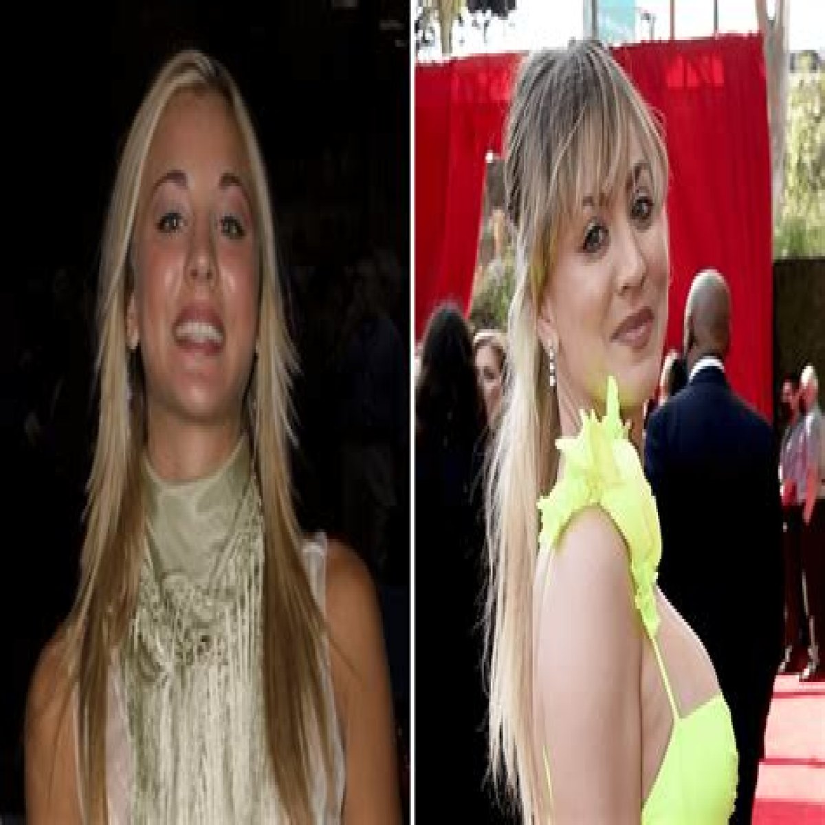 Kaley Cuoco Is Honest About Her Plastic Surgery! See the Actress’ Beautiful Transformation 