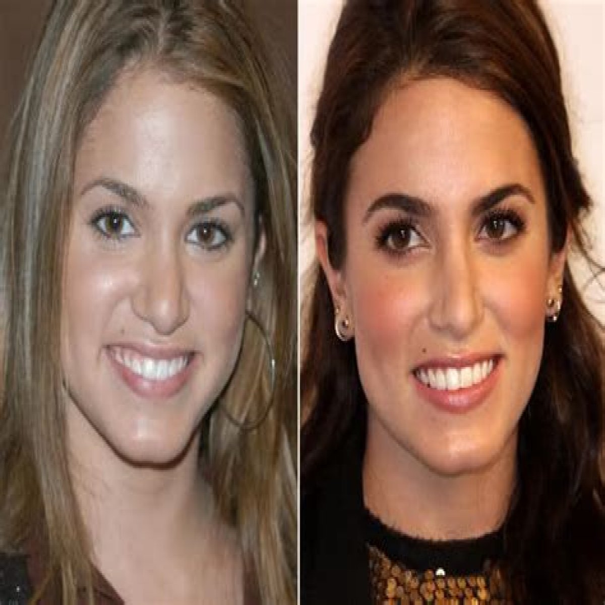 Nikki Reed Plastic Surgery Before and After