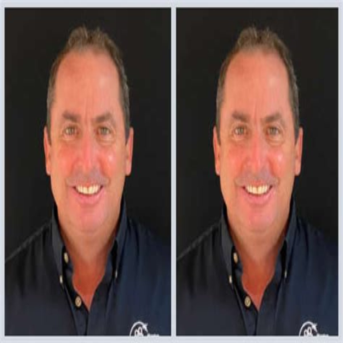 What Happened To Dentist Tom Menton? Obituary And Death Cause Linked To Suicide